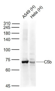 C5b-9 Rabbit Polyclonal Antibody (FITC)