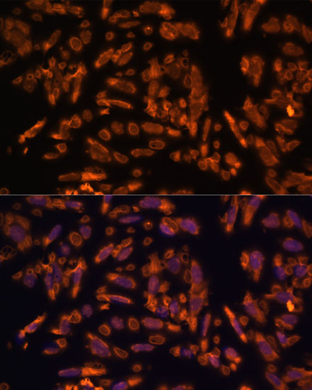 PRX polyclonal antibody
