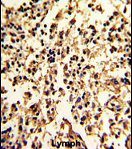 SERPINA9 Antibody (Center)
