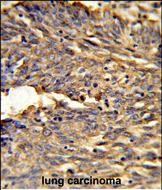 HBA2 Antibody (Center)