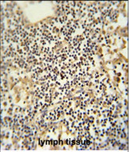 TMUB1 Antibody (Center)