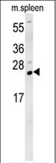 TMUB1 Antibody (Center)