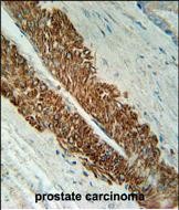STEA2 Antibody (Center)