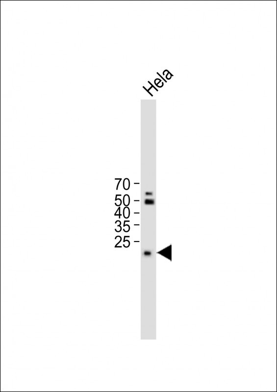 TM4SF1 Antibody (N-term)