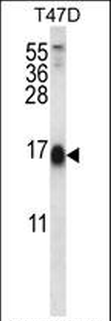 SKA2 Antibody (N-term)