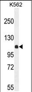 KIAA1324L Antibody (N-term)