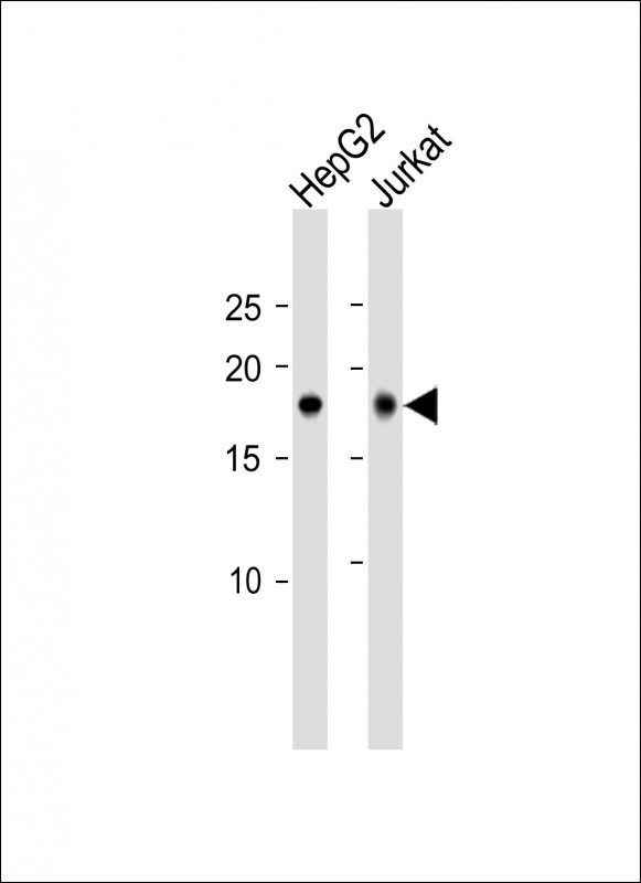 CAMK2N1 Antibody (C-term)