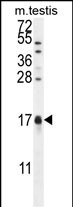 CAMK2N1 Antibody (C-term)