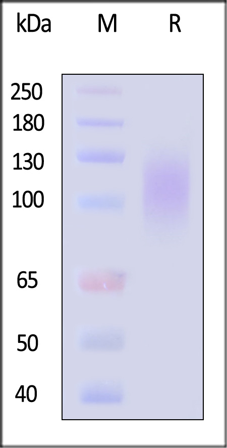 HIV-1 GP120 Protein, His Tag