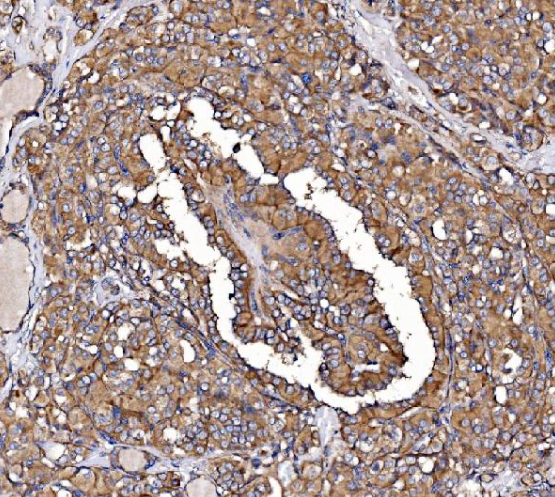GPR54/KISS1R Antibody