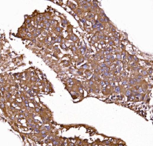 GPR54/KISS1R Antibody