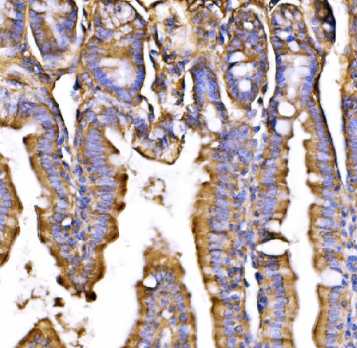GPR54/KISS1R Antibody