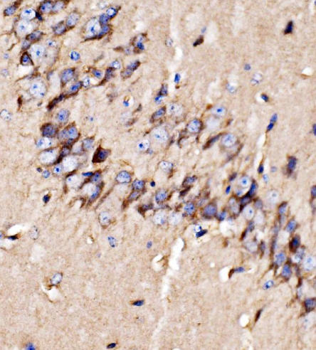GPR54/KISS1R Antibody