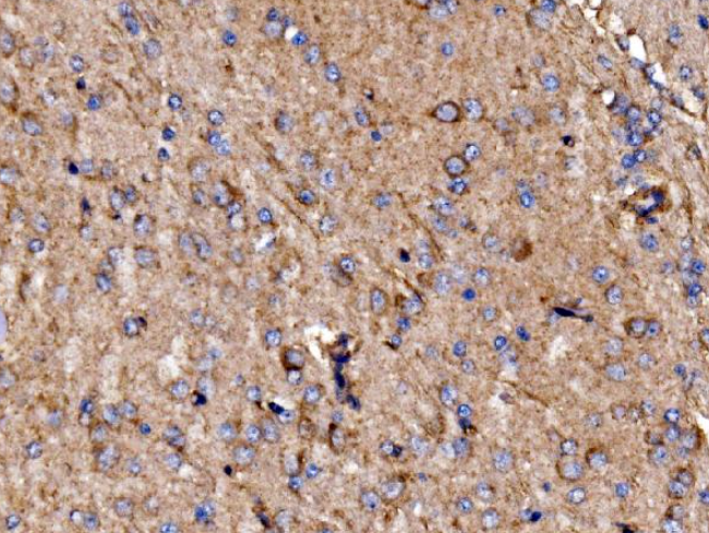 GPR54/KISS1R Antibody