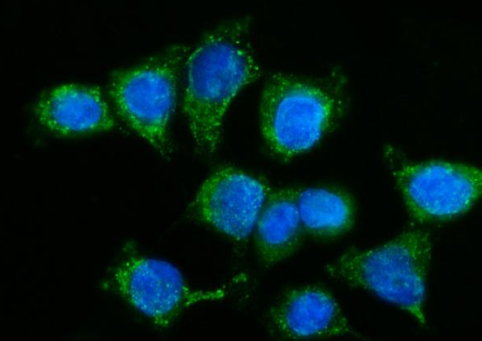 GPR54/KISS1R Antibody