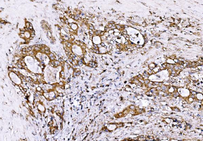 GPR54/KISS1R Antibody