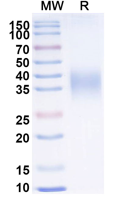 Recombinant EBV/HHV4 GP42/Glycoprotein 42 Protein, C-His