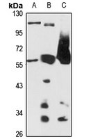 SPPL2a Rabbit Polyclonal Antibody