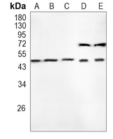 CCR3 Rabbit Monoclonal Antibody