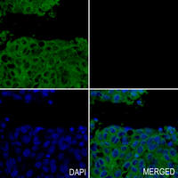CCR3 Rabbit Monoclonal Antibody