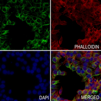 CCR3 Rabbit Monoclonal Antibody