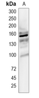 AKNA Rabbit Polyclonal Antibody