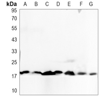 Caspase 8 p18 Rabbit Polyclonal Antibody