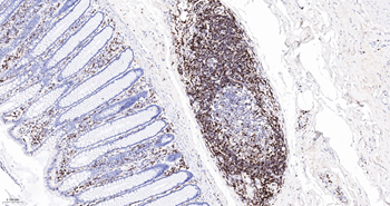 CD45RO Mouse Monoclonal Antibody (8G8)