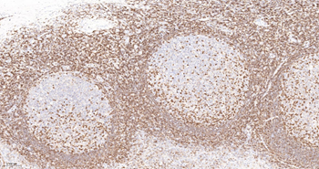 CD45RO Mouse Monoclonal Antibody (8G8)