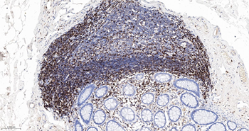 CD45RO Mouse Monoclonal Antibody (8G8)