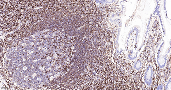 CD45RO Mouse Monoclonal Antibody (8G8)