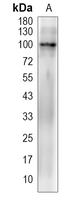 GUCY2D Rabbit Polyclonal Antibody