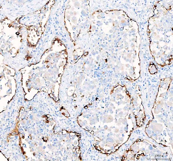 SLC34A2 Antibody