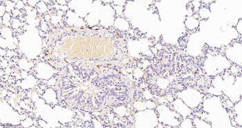 CD163 Recombinant Rabbit Monoclonal Antibody
