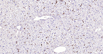 CD163 Recombinant Rabbit Monoclonal Antibody