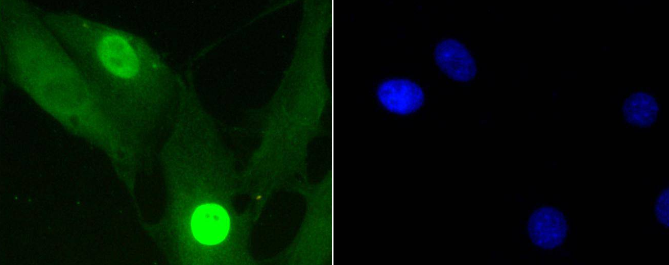 Histone H1.3(Phospho-T17)+Histone H1.4(Phospho-T17) Antibody