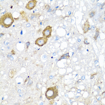 MGP polyclonal antibody