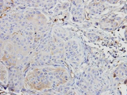 A-RAF Rabbit Polyclonal Antibody