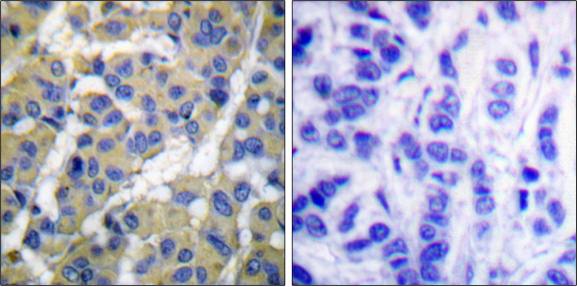 Keratin 8 (Phospho-Ser74) Antibody