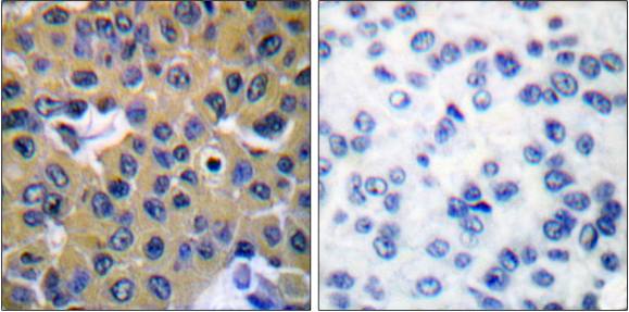 SHP-2 (Phospho-Tyr542) Antibody