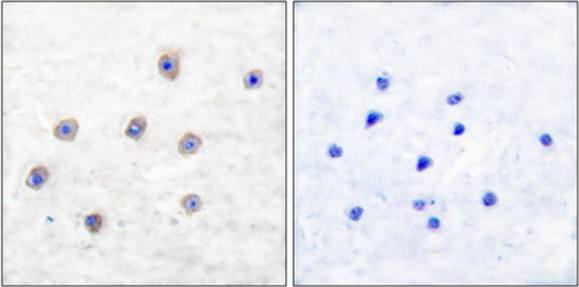 Tyrosine Hydroxylase (Phospho-Ser31) Antibody