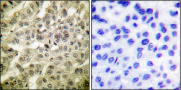 Akt (Phospho-Thr308) Antibody