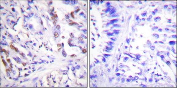 CDC25A (Phospho-Ser76) Antibody