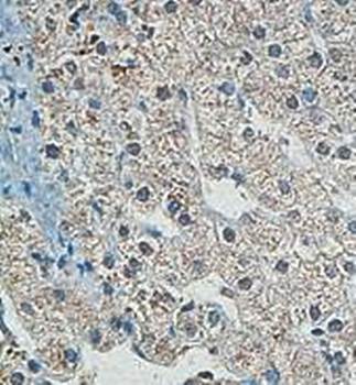 A1BG Rabbit Polyclonal Antibody