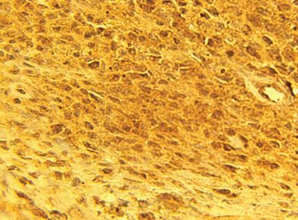 Rabbit anti Human Calcium Channel Antibody