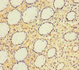 A4GNT Antibody