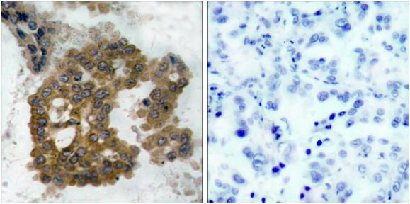 Akt2 (Phospho-Ser474) Antibody