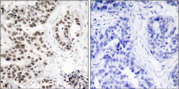 Chk2 (Phospho-Thr68) Antibody