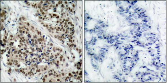 FKHR (Phospho-Ser256) Antibody