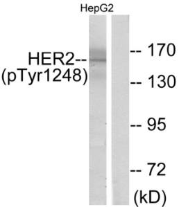 HER2 (Phospho-Tyr1248) Antibody